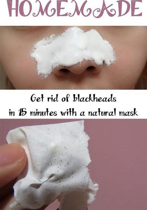 Homemade Blackheads Remover Tutorials And Ideas Homemade Face Mask