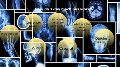 How Do X Ray Machines Work By Abigail Simpson