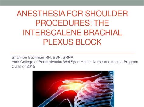 Ppt Anesthesia For Shoulder Procedures The Interscalene Brachial