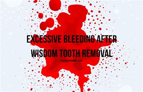 Excessive Bleeding After Wisdom Tooth Removal What Now Ear Nose