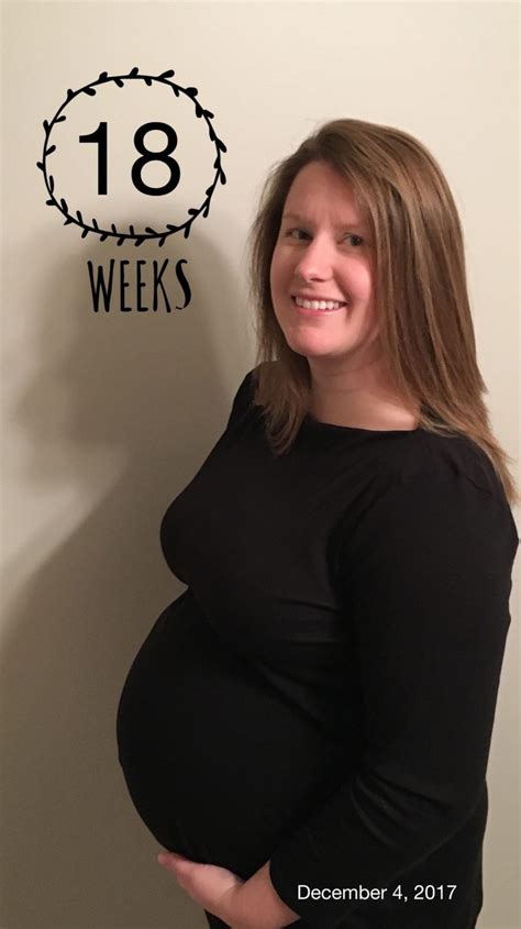 18 Weeks Pregnant With Twins Tips Advice And How To Prep Twiniversity