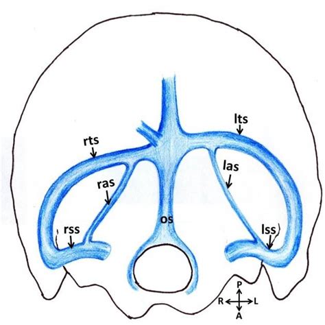 Dissection Of Cranial Cavity Showing The Infratentorial Space Note