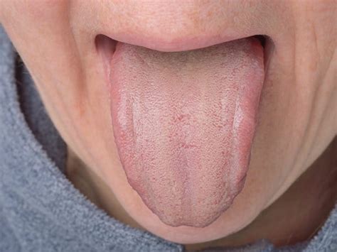 Warning Signs Your Tongue Could Be Sending About Your Health Business