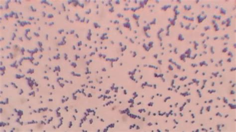 Gram Positive Cocci In Pairs And Chains