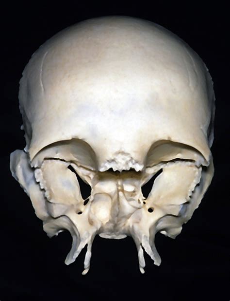 Anterior View of the Frontal and Sphenoid Bones | Neuroanatomy | The ...