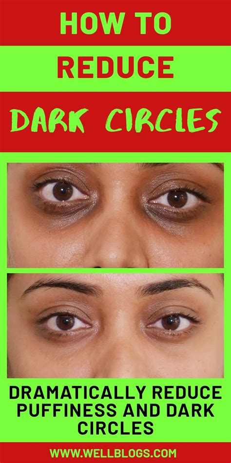 How To Reduce Dark Circles Under Eyes Reduce Dark Circles Dark