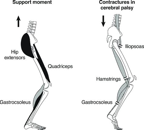 The Sagittal Plane Motors For The Lower Limb Of The Three Muscle