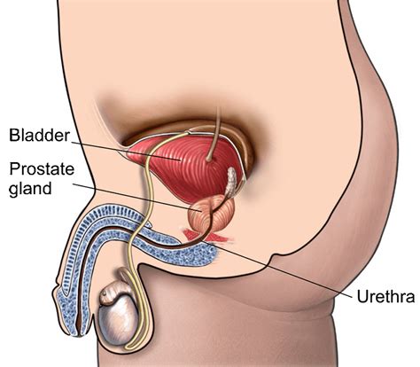 Tubal Ligation Incision