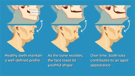 Oral And Maxillofacial Surgery