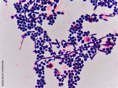 Budding Yeast Gram Stain