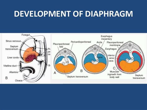 Diaphragmatic Hernia