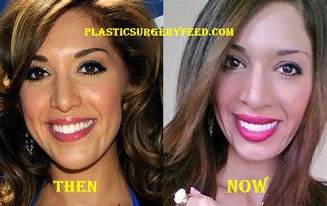 farrah abraham plastic surgery before and after plastic surgery feed