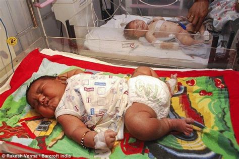 Biggest Baby Ever Born In India Is A Massive 13lb How Big Is Baby