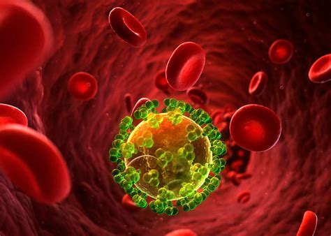 Científicos Eliminan El Virus Del Vih Con Trasplante De Células Madre