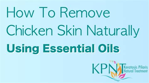How To Remove Chicken Skin Naturally Using Essential Oils Video Youtube
