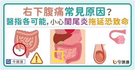 右下腹痛常見原因？醫指各可能，小心闌尾炎拖延恐致命！