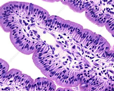 Intestinal Villi Light Micrograph Stock Image C0475723 Science