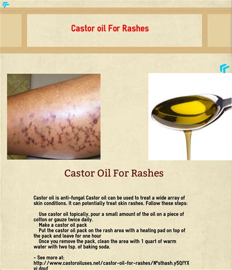 Castor Oil For Rashes Castor Oil For Skin Castor Oil Castor Oil