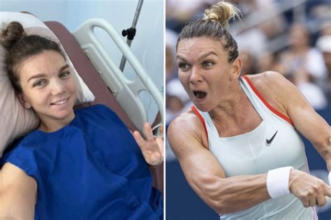Two Time Grand Slam Winner Simona Halep Undergoes Nose Surgery After