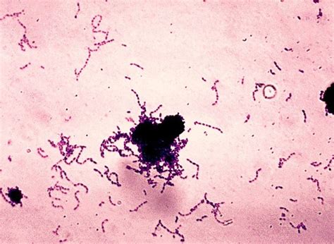 Streptococcus Bacteria In Groups A And B Facts And Diseases Youmemindbody