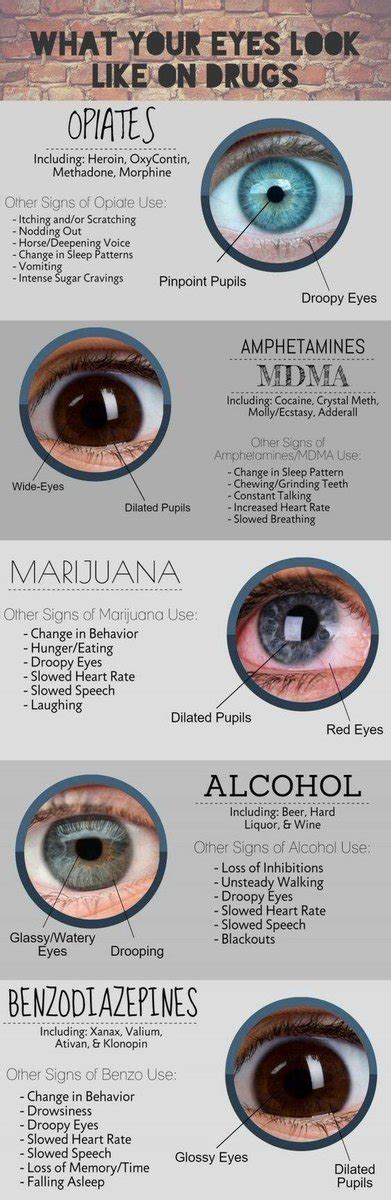 Pinpoint Pupils And Drugs Xolerbeer