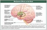 Effects Of Smoking Marijuana Pictures