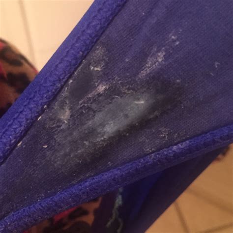 Tmi Does Anyone Else Get Discharge Like This On Their Underwear Every Day Glow Community