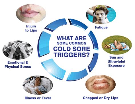 Attdx Coldsores Treatment Oil W I Z Z G O O C O M