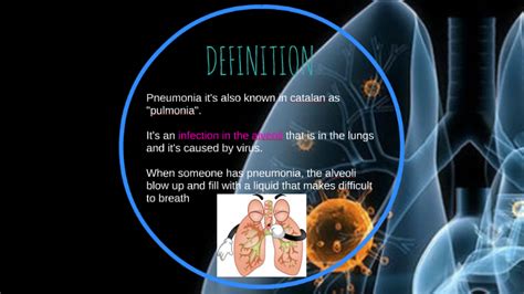 Pneumonia Is An Inflammatory Condition Of The Lung Affecting By Eli