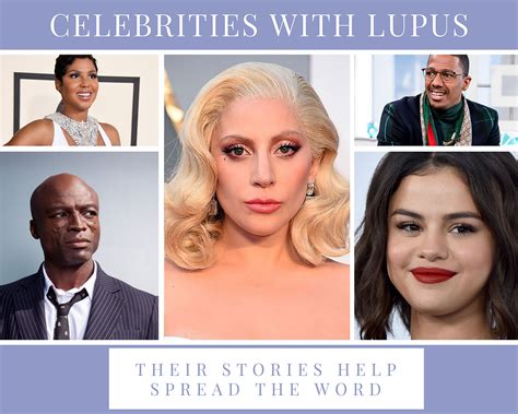 Celebrities With Lupus