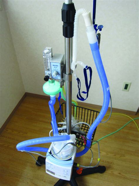 Noise Exposure From High Flow Nasal Cannula Oxygen Therapy A Bench Study On Noise Reduction