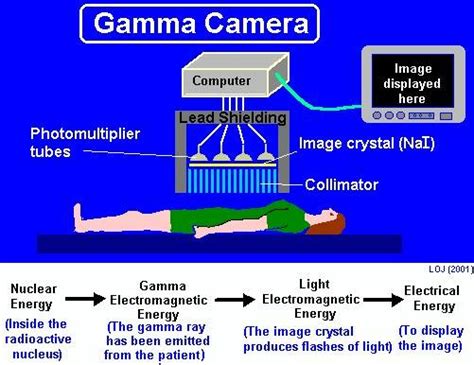 Biomedical Engineering Gamma Cameras