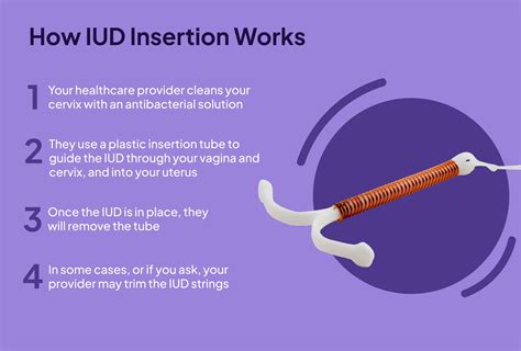 IUD Insertion How It Works And What To Expect
