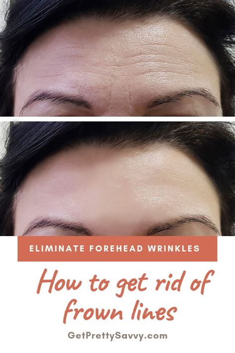 How To Get Rid Of Frown Lines Getprettysavvy Forehead Wrinkles