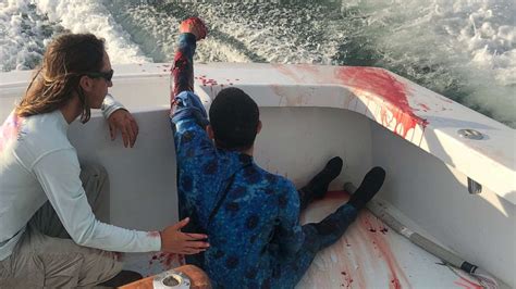 Diver Attacked By Shark Rescued By Fishing Boat Full Of Nurses In