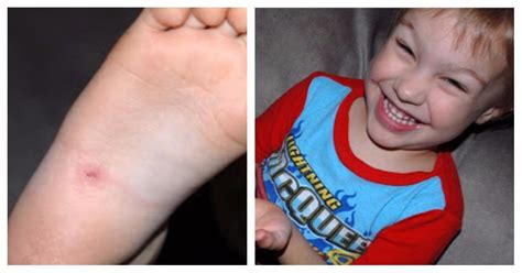 Splinters, cactus spines, thorns, toothpicks. What his mother uses to remove a splinter from his foot is ...