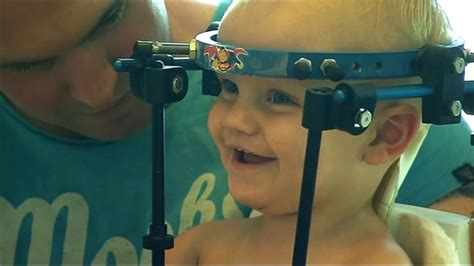 Jaxon Taylor Injury Toddlers Head Reattached After Internal Decapitation