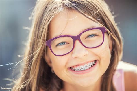 Can You Get Braces For Only Top Or Bottom Teeth Orthodontic Arts