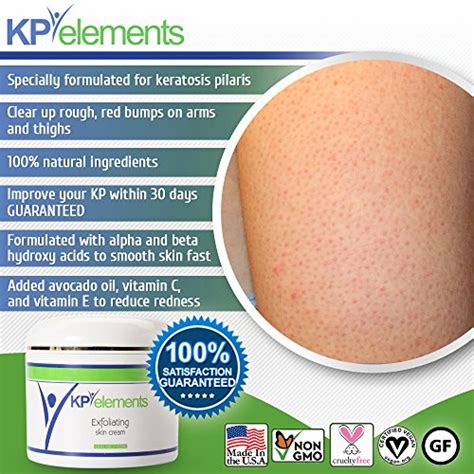 Kp Elements Keratosis Pilaris Treatment Cream Keratosis Pilaris Cream