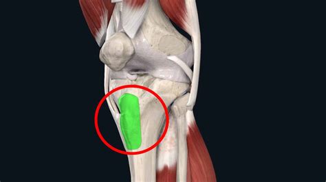 Osgood Schlatter Disease Causes Symptoms And Treatment Airrosti