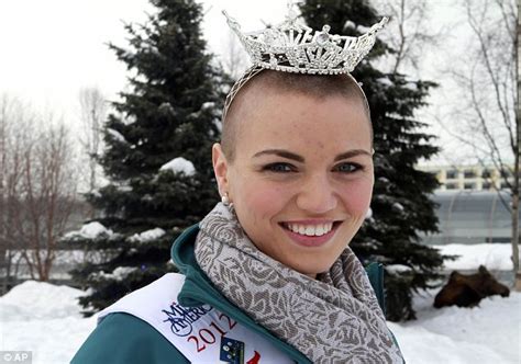 Delightful News Beauty Queen Goes Bald For Cancer Research