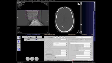 Ct Scan Of Pns Technic Full Process Youtube