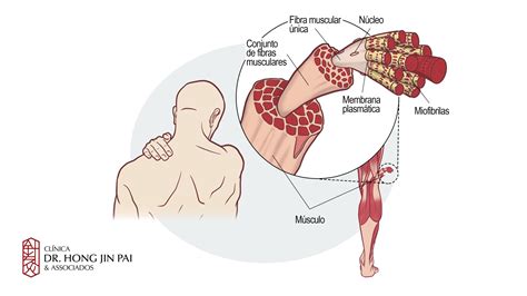 Quais As Estruturas Responsáveis Por Detectar Alterações No Comprimento Muscular