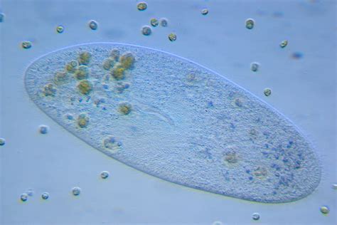 Paramecium Best Viewed Large 40x Oblique 10x Through Eye Flickr