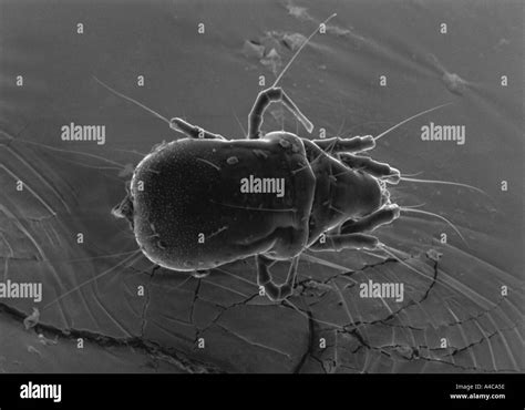 Scanning Electron Microscope Image Of Mite Stock Photo Alamy