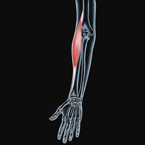 Brachioradialis Muscle Injuries Strategies For Successful Recovery