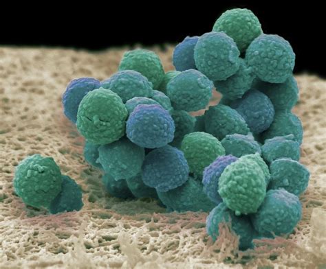 Staphylococcus Epidermidis Bacteria Photograph By Steve Gschmeissner