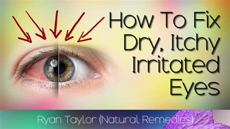 How To Cure Dry Eyes Fast Natural Remedies Youtube