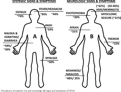 Myalgia is a symptom of many diseases. Headache Myalgia - Cluster Headaches
