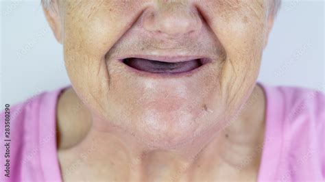 Toothless Mouth An Elderly Woman With No Teeth Old Granny With Her Mouth Open Stock Photo